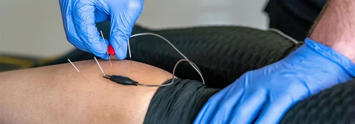 Chiropractor Kirkwood MO Alec Morrison Dry Needling